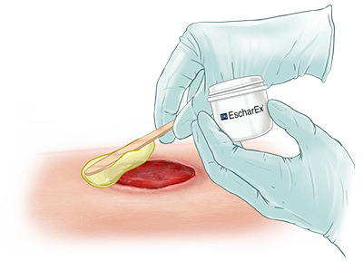 Topical Application